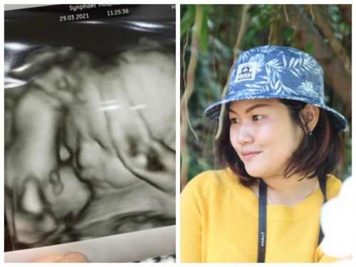 ลูกบ้านไหนซาวด์แล้วหน้าตาเหมือนคุณแม่บ้างคะ อวดกันหน่อย #29w