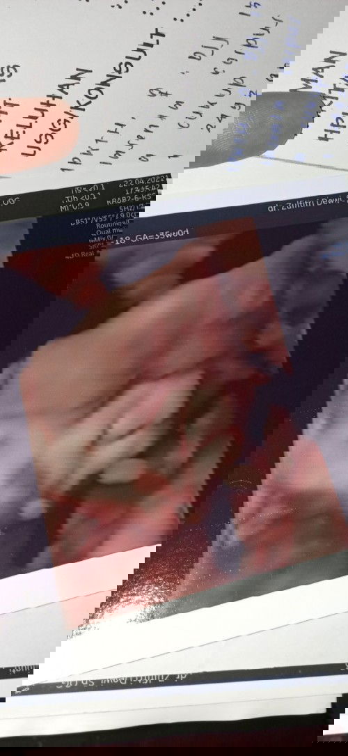 Apa saja yang bunda rasakan pada usia kehamilan 35week?
Sama kah dengan saya, sling berbagi yuk bund