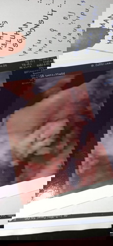 Apa saja yang bunda rasakan pada usia kehamilan 35week?
Sama kah dengan saya, sling berbagi yuk bund