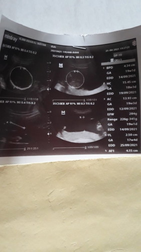 Mau tanya,21 April qUSG tau y usia khmiln y sdh 19w. Akuratan hasil usg/hitungan qta pas terakhir M