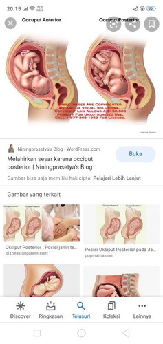 Posisi posterior