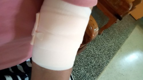 ฝังเข็มหลังคลอด