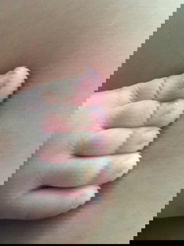 นิ้วกลางเท้าลูก