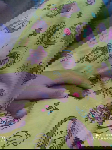 Setiap sore punggung nyeri sampai perut dan nafas ngos2an selama puasa