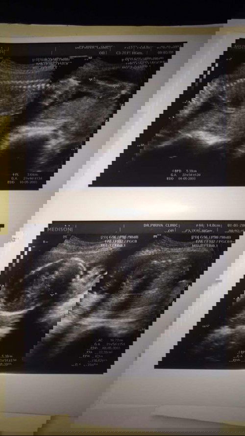 น้ำหนักลูกๆ เท่าไรกันบ้างค่ะ กี่วิคกันเอ่ย