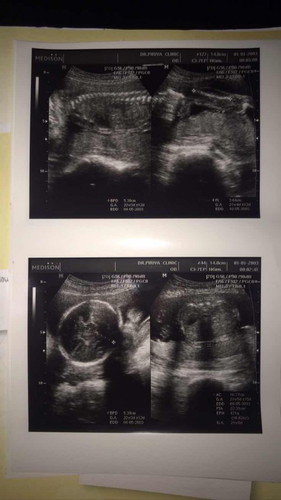 น้ำหนักลูกๆ เท่าไรกันบ้างค่ะ กี่วิคกันเอ่ย