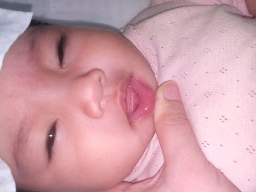 Các mẹ cho e hỏi có mẹ nào còn bị như này ko ạ? Bé nhà mình 4m20d lợi hàm dưới bị trắg như này có