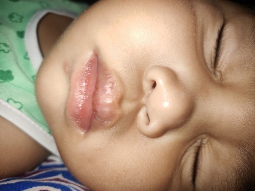 สอบถามผู้รู้ค่ะ ใช่มือเท้าปากไหมคะ