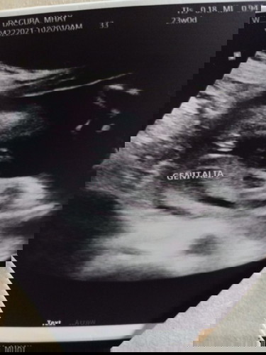 Ultrasound