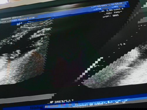 ขอถามหน่อยค่ะ