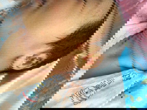 ตุ่มหนองตามตัว