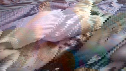 Tulang rusuk seperti menonjol