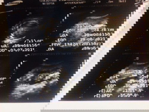 Mau nnya dong bun rata rata hamil 7 bulan BB janin nya brpa ya