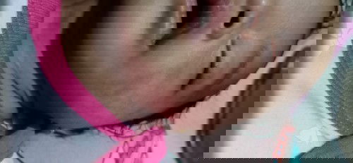 Bintik merah pada pipi