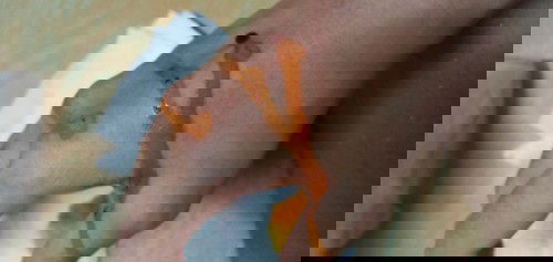 Di gigit kucing tetangga