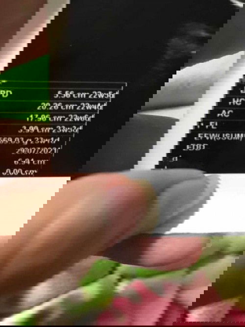 น้ำหนักตามเกณฑ์มั้ยคะ #ท้องแรกคะ