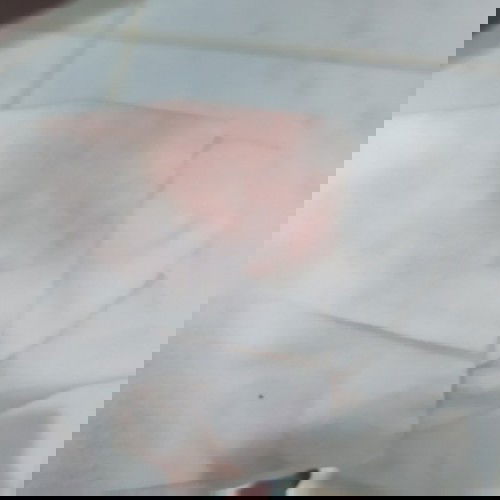 Hi po ask ko Lang po na normal Lang po ba magka discharge nang ganito?