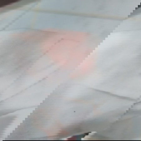 Hi po ask ko Lang po na normal Lang po ba magka discharge nang ganito?