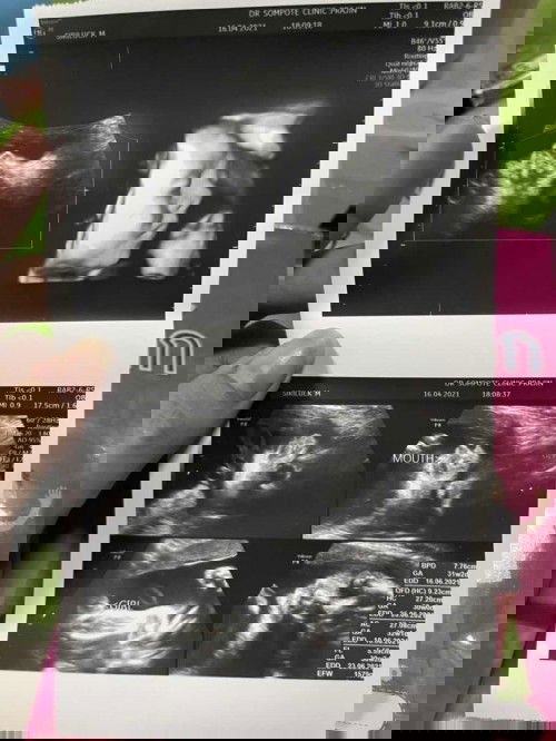 ลูกสาวจ้า 30w แล้ว
เดินจะไม่ไหวแล้ว😂#ท้องแรกค่ะ