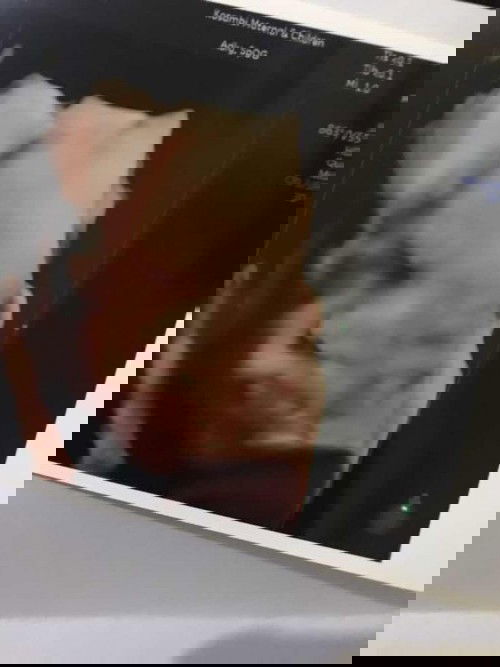 Ekspresi Marah pas USG