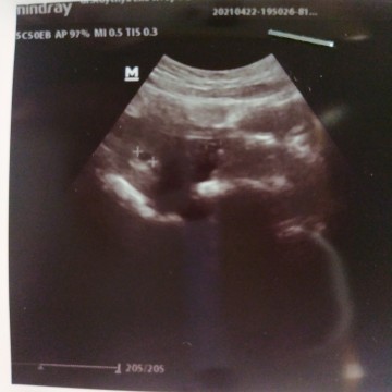 5 week 3 day