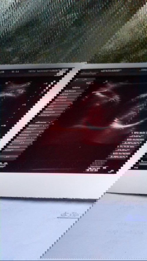 Duh Bun gimn  kepala pusing  apa ini efek nya orang hamilll serius tanya niii