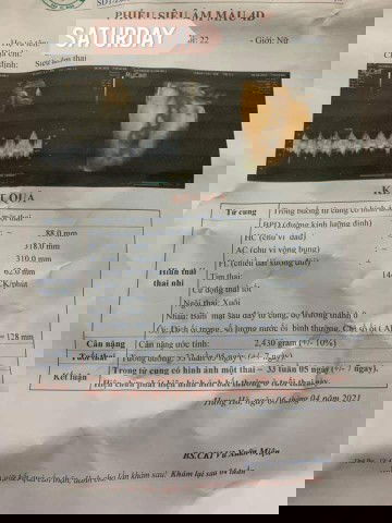 Bầu
Chỉ uống ngủ cốc mà bé tăng cân vượt chuẩn 33w 2.4kg