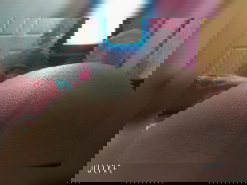 เดียวตึงเดียวดิ้นเจ็บรอบท้องปกติไหมคะ