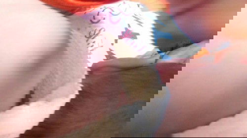 bekas suntikan imunisasi