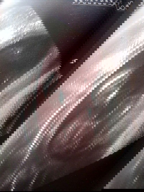 อยากถามแม่ๆหน่อยค่ะว่าน้องเป็นผู้หญิงหรือผู้ชายคะ พอดีดูไม่เป็นค่ะ