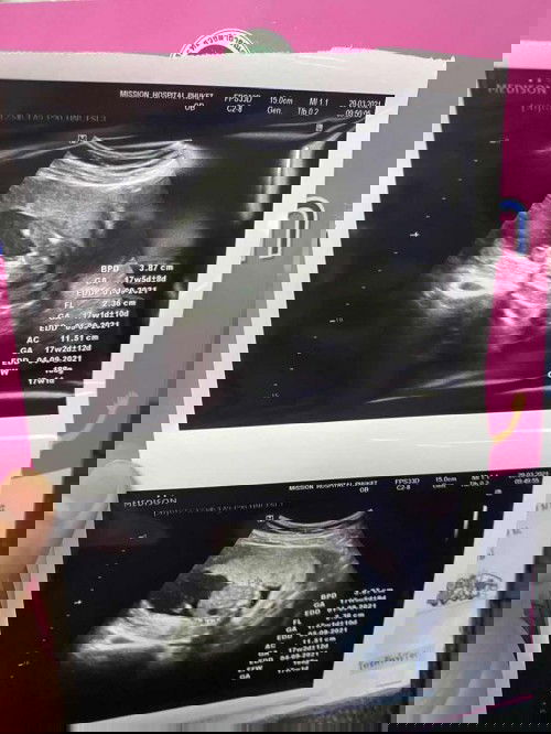 29 มีนาคม 2564