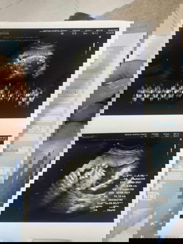 26 เมษายน 2564
