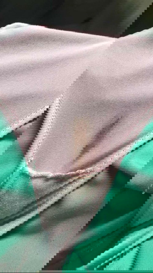 ปจด ขาด2เดือน ตกขาวสีน้ำตาล