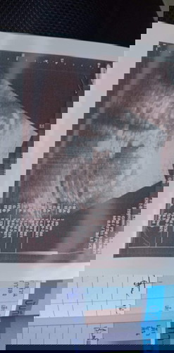 ขออนุญาตสอบถามแม่ๆหน่อยค่ะ อันนี้ไม่รู้จริงๆค่ะ #ท้องแรก