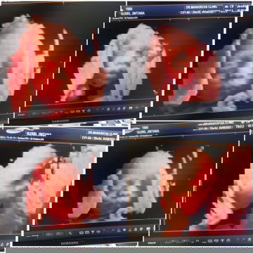 ทีมสิงหาคม64