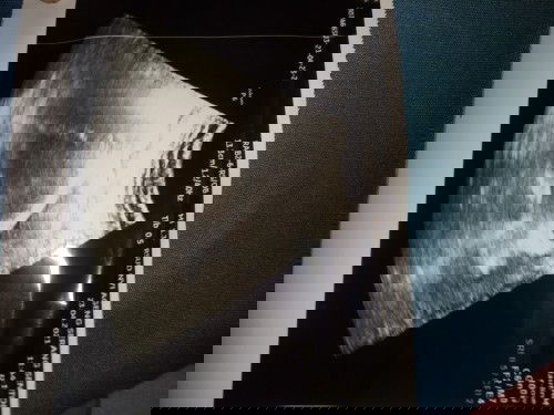 Bunda2 tanya,  saya hamil 4mgg 6hari,  tapi pas usg hasilnya gini belum kelihatan embrionya,  gmn ya