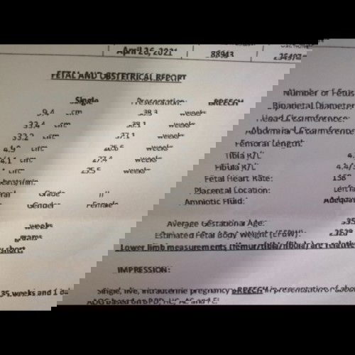 Same case, meron po ba???