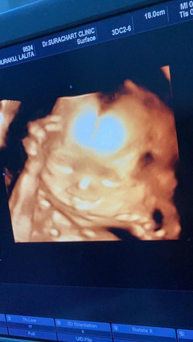 ทีมสิงหาค่ะ”//