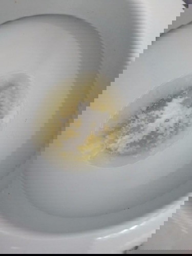 ask ko lang po kung anu po tong lumabas skin. I'm 39 weeks and 4 days na po ako.