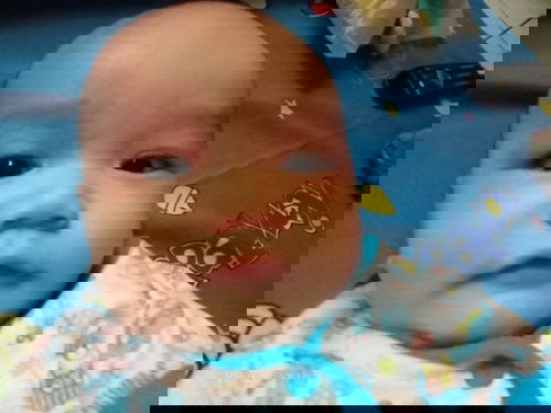 Sekitar mata merah dan berbintik