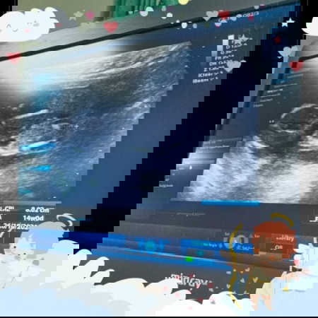 ตื่นเต้น อยากรู้เพศลูกค่ะ