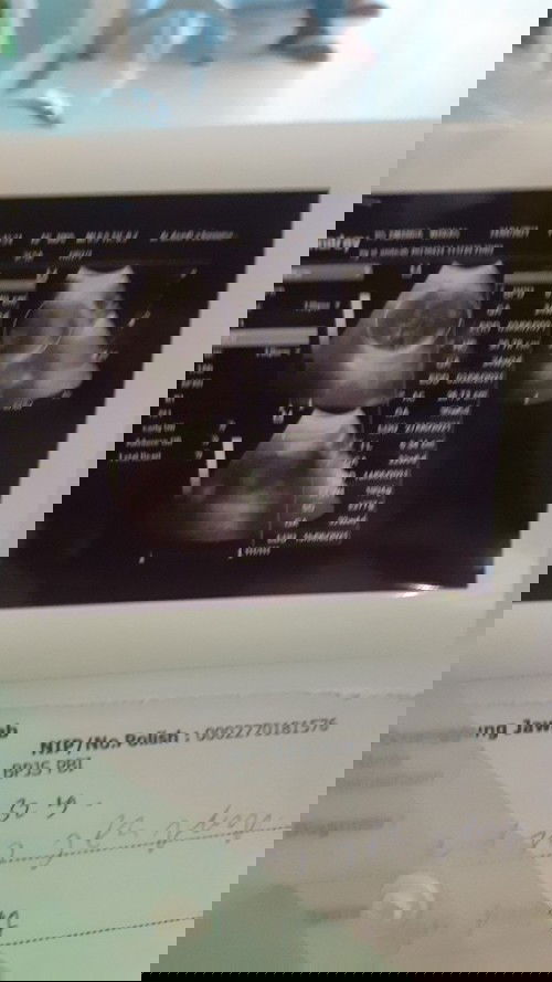 Minggu ke 33 hari ke 5