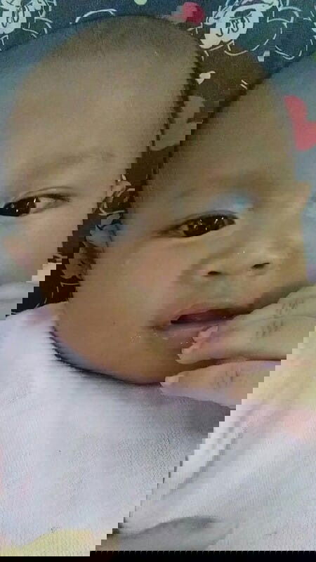 kulit putih disekitar mata