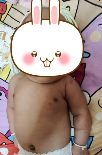 ปานสตอเบอรี่