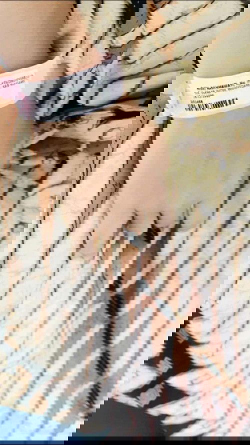 Sesar lagi dikehamilan kedua