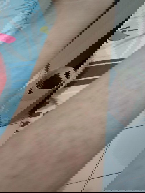 Kulit bentol ² merah pasca melahirkan Caesar