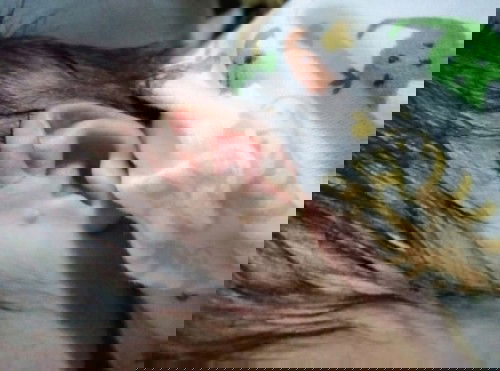 melenting di telinga