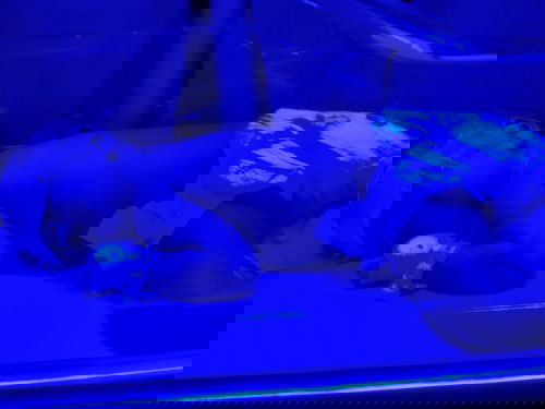 เครียดมากคะเพิ่งคลอด6วันดูตาน้องเหลืองๆเลยไปหาหมออีกทีต้องนอนรพ.เลย