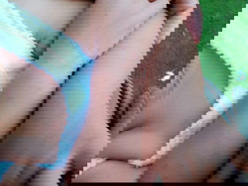 Bintik" merah dan menyebar