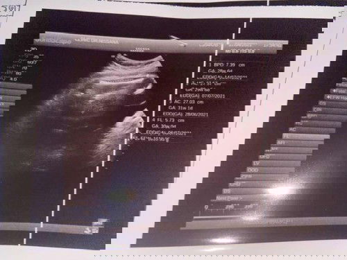 30 วีค 6 วัน